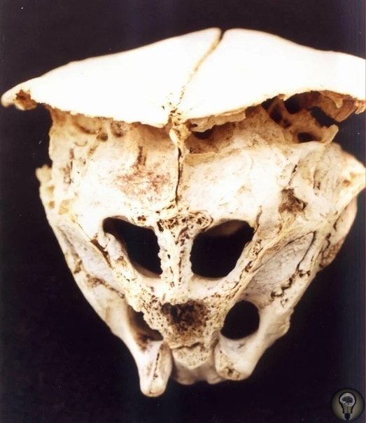 Древний череп, происхождение которого вызвало много вопросов Загадочный череп обнаружили в 2001 году, но история обнаружения этого черепа, не менее удивительна, чем сам череп.Мужчина, который