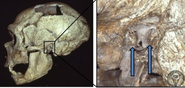 Древние неандертальцы страдали «ухом сёрфера»