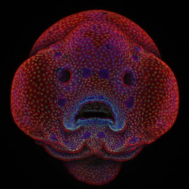 Четырех-дневный эмбрион аквариумной рыбки «Дамский чулок». 