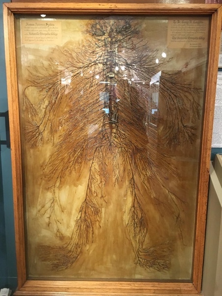 В 1925 году два студента-медика создали этот уникальный экспонат Им потребовалось 1500 часов чтобы препарировать нервную систему человека целиком. На сегодня в мире известны всего 4 таких