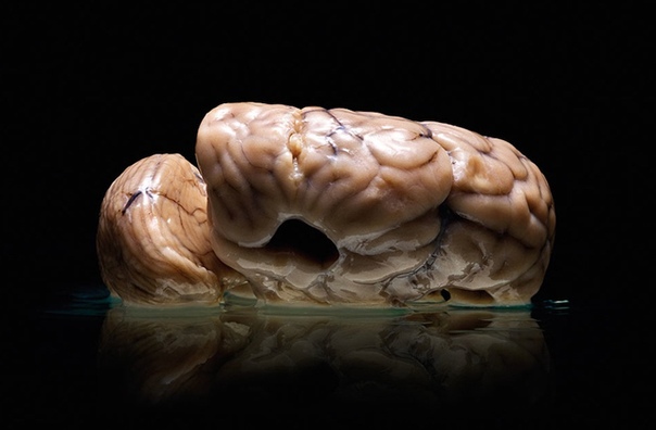 Это редчайшая коллекция фотографий человеческих мозгов, которую собрал фотограф Адам Вурхес Он выполнял редакционное задание научно-популярного журнала Scientific American и по долгу службы