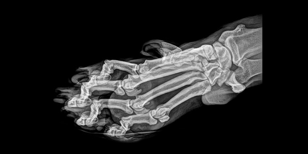 Рентген: уникальный взгляд на анатомические особенности различных видов животных Орегонский зоопарк (Oregon Zoo) опубликовал рентгеновские снимки животных, сделанные во время обычных медицинских