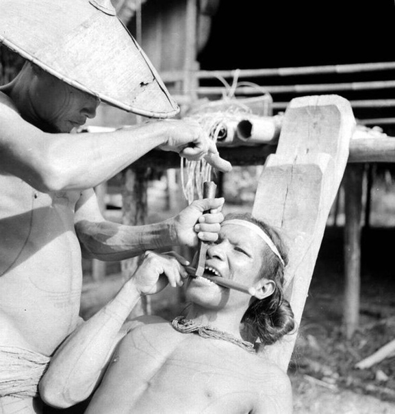 Вот как в 1938 году в Индонезии выглядела церемония спиливания зубов напильником. Кстати, подобная традиция до сих пор в ходу на Бали и носит название «гиги потонг». Дело в том, что клыки и