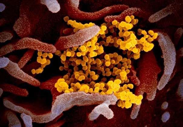 Лаборатории Скалистых гор (RML Национального института аллергии и инфекционных заболеваний (NIAID) опубликовали снимки коронавируса, сделанные с помощью просвечивающего электронного микроскопа.